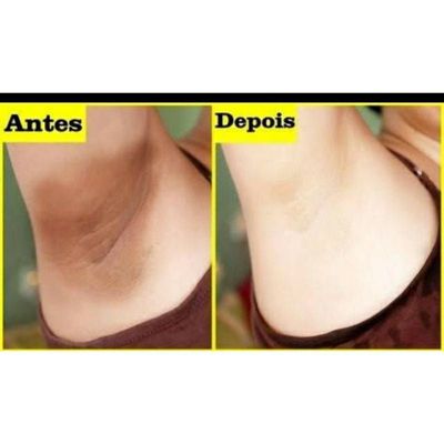 Pomada Micosan Revendedor 12 potes com 50g