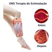 Massageador Para Pernas E Braços Recarregável