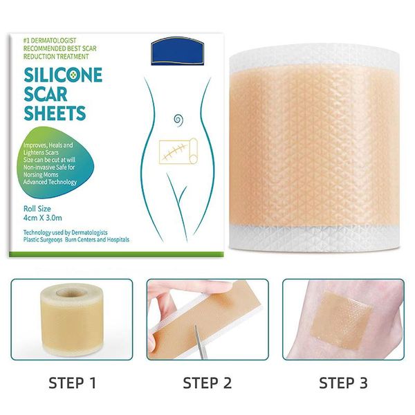 Pasta de Silicone para Cicatrizes 150/300 cm - Tratamento de Acne e Queimaduras P