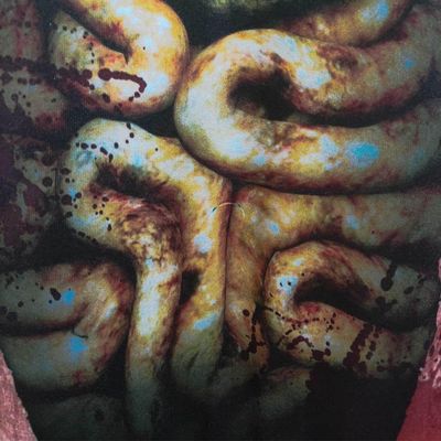 Fantasia De Zumbi Masculino Infantil Tamanho G