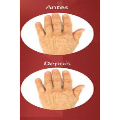 Clear Pele - Creme P/ Amenizar Marcas Senis Nas Maos 60Gr (3408)